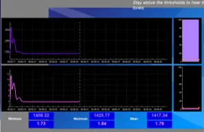 エメラルド筋電図バイオフィードバックリハビリテーションで使用するプログラム３